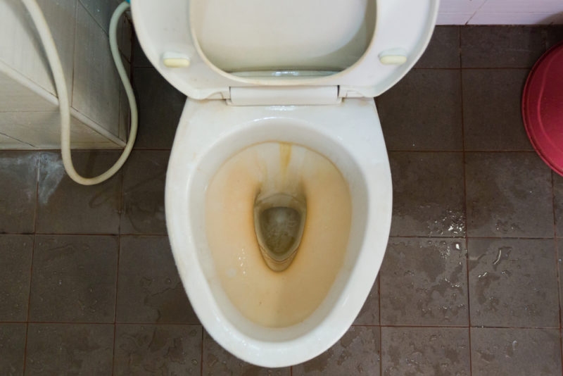 Antalya Tuvalet Tıkanıklığı Açma